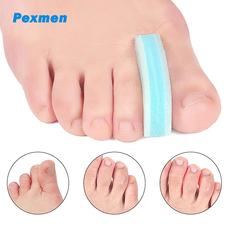 

Pexmen 2Pcs/Bag Foam Toe Separator Spacer for Overlapping Toes Hammertoe Prevent Friction and Release Pressure Bunion Corrector