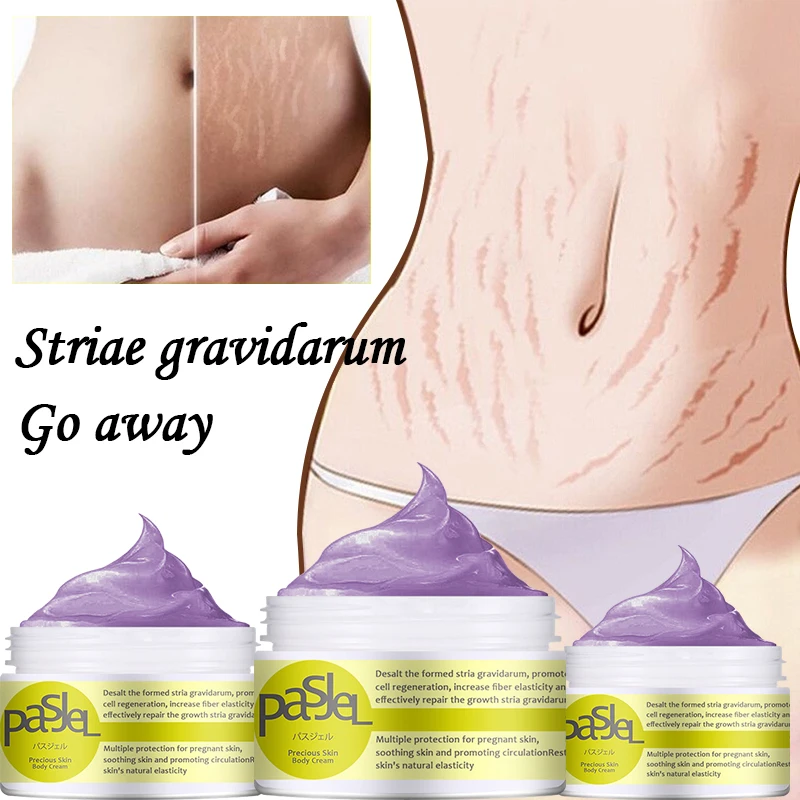 

Maternity Stretch Marks Removal Cream Body Buttock Breast Mark Skin Care Effective Anti White Stretch Scar Remover Cream 50g