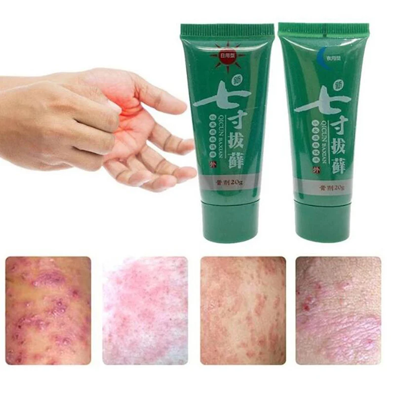 

Дневной и ночной крем для тела от псориаза, мазь от дерматита, экзематоида, экземы, стерилизация кожи, Лечебный крем от псориаза для наружног...