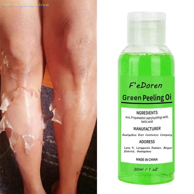 Желтое пилинговое масло для тела Отбеливающее отшелушивающее средство темных и