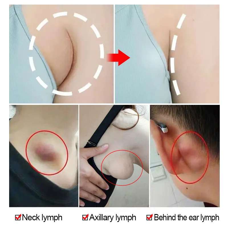 Chinese Herbal Lymphatic Detox Patches 8PCS/Bag Skin Care Anti-Swelling Plaster for Armpits & Neck NOV99 |