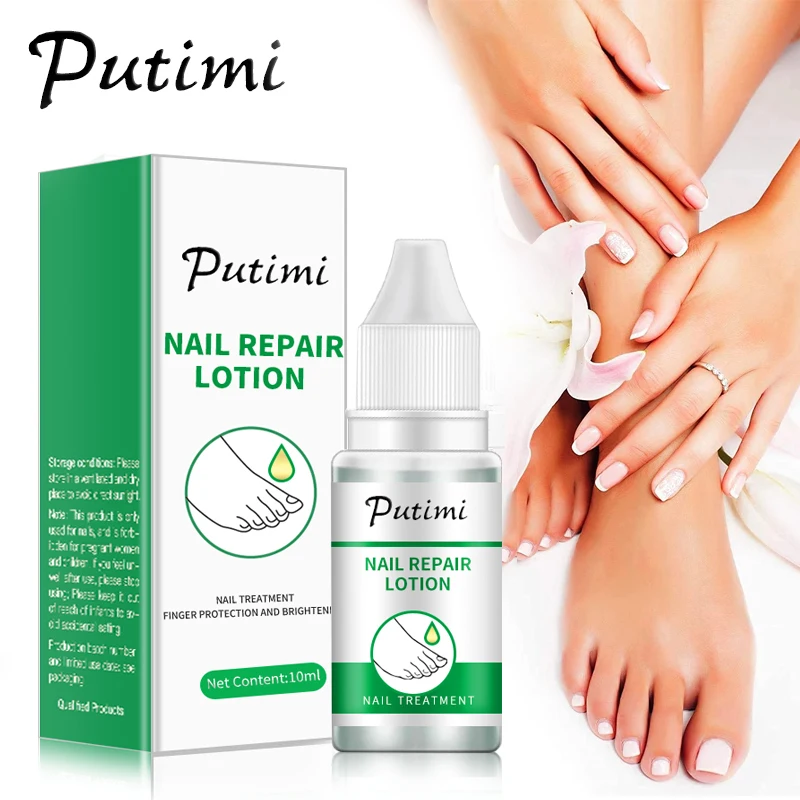 

PUTIMI Nail Treatment Essence Nail Fungus Repair Lotion Foot Care Toe Fungal Removal Gel Anti Infection Paronychia Onychomycosis