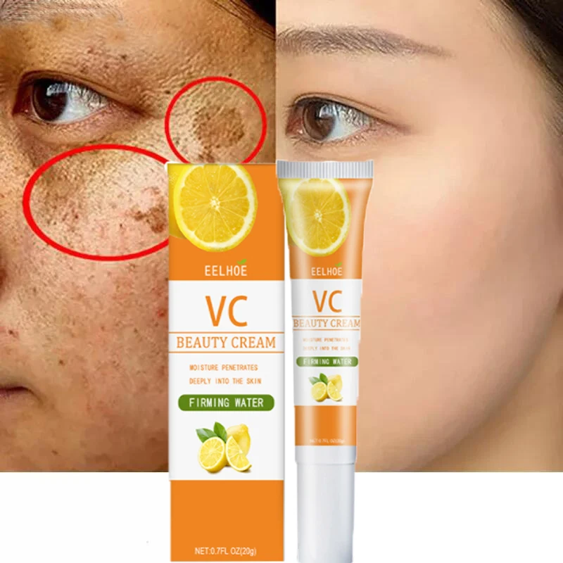 

Vitamin C Whitening Freckles Cream Remove Melasma Dark Spots Lighten Melanin Moisturizing Brightening Face Care Beauty Products