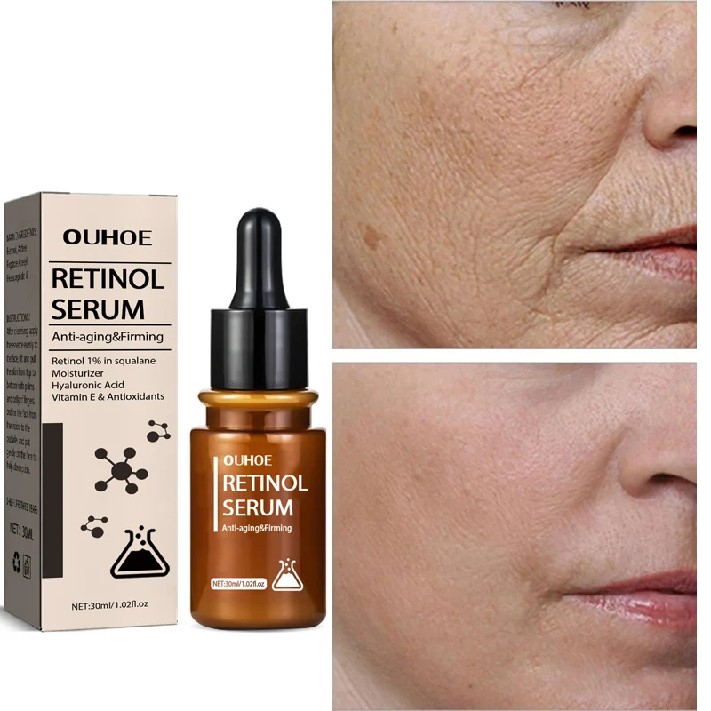 Retinol Wrinkles Remove Face Cream Anti-Aging Firm Lift Fade Dry Lines Nourish Moisturizer Improve Dull Rough Skin Care Products