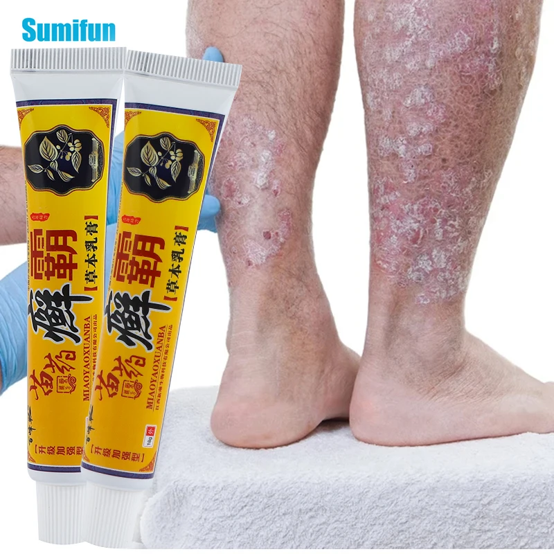 

18g Psoriasis Antibacterial Cream Dermatitis Eczematoid Ointment Effective Anti-Itch Chinese Herbal Medical Skin Health Care