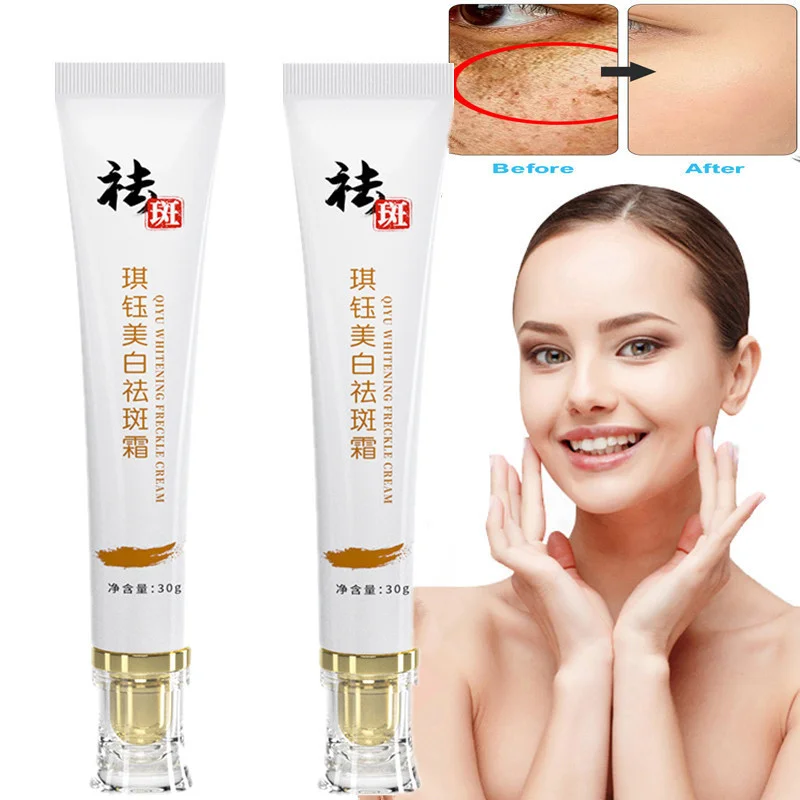 

Whitening Freckle Face Cream Effective Acne Spot Melanin Remover Melasma Brighten Skin Anti-Aging Lightening Skin Care