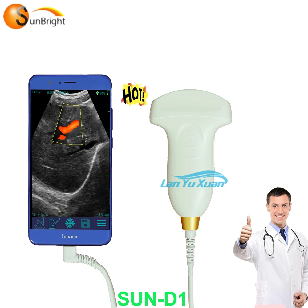 

USB Probe convex for android laptop PC Factory Price Portable Ultrasound, USB probe