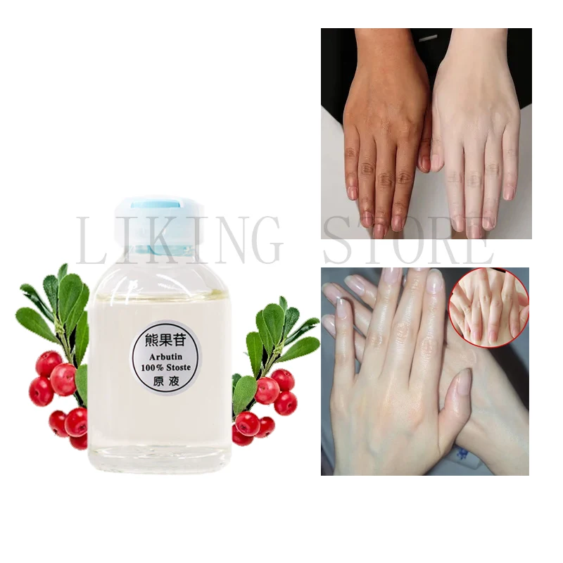 

Arbutin Skin Whitening Serum Hand Feet Skin Brightening Essence Liquid Removing Chloasma Dark Knuckles Lightening Essential Oil