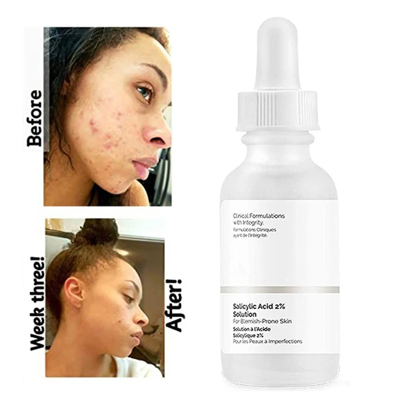 

Salicylic Acid 2% Solution Essence 30mL Acne Spot Removing Shrink Pores Oil-Control Brighten Face Skin Makeup