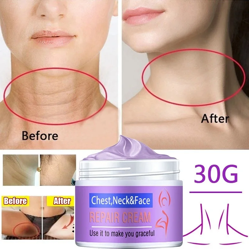 

Retinol Neck Firming Wrinkle Remover Cream Anti Aging Fade Fine Lines Lift Shaping Whiten Moisturizing for Chest Face Skin Care