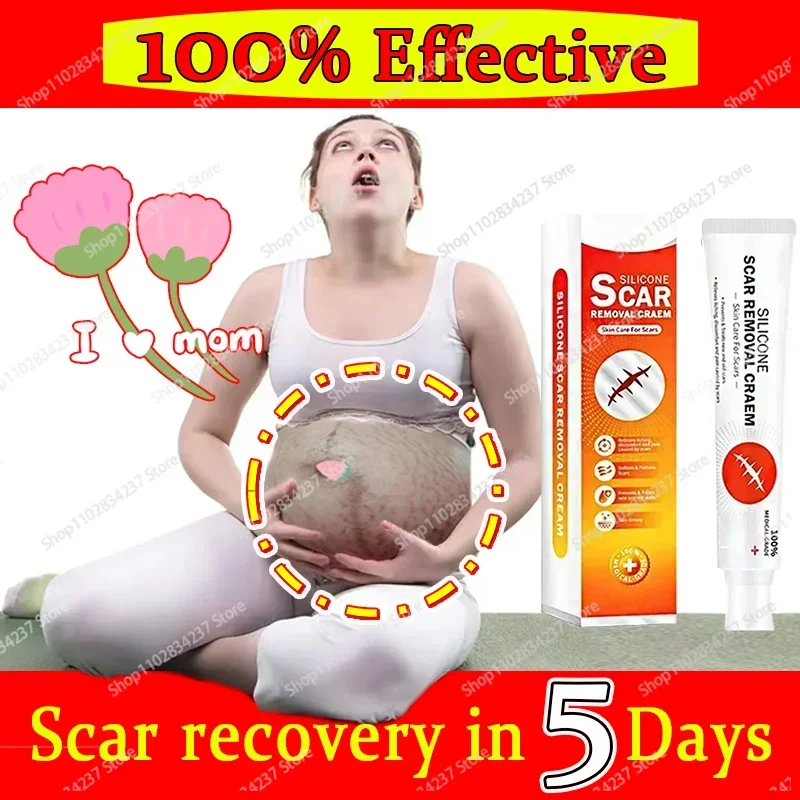 ГОРЯЧАЯ ПРОДАЖА восстанавливающий крем для удаления шрамов от прыщей растяжек