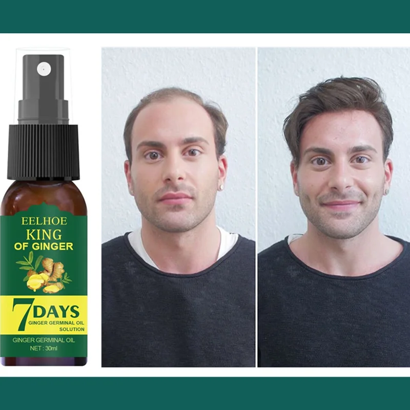 30ML Ginger Hair Growth Spray Oil Men Women Fast Promote Hair Growing Thicker Anti Hair Loss Scalp Treatment Nourish Hair Serum