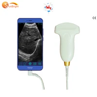 usb ultrasound usg wireless ultrasound probe connector ios android mobile scanner device