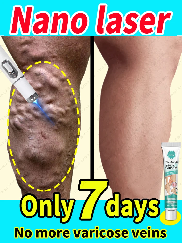 Промова кровь