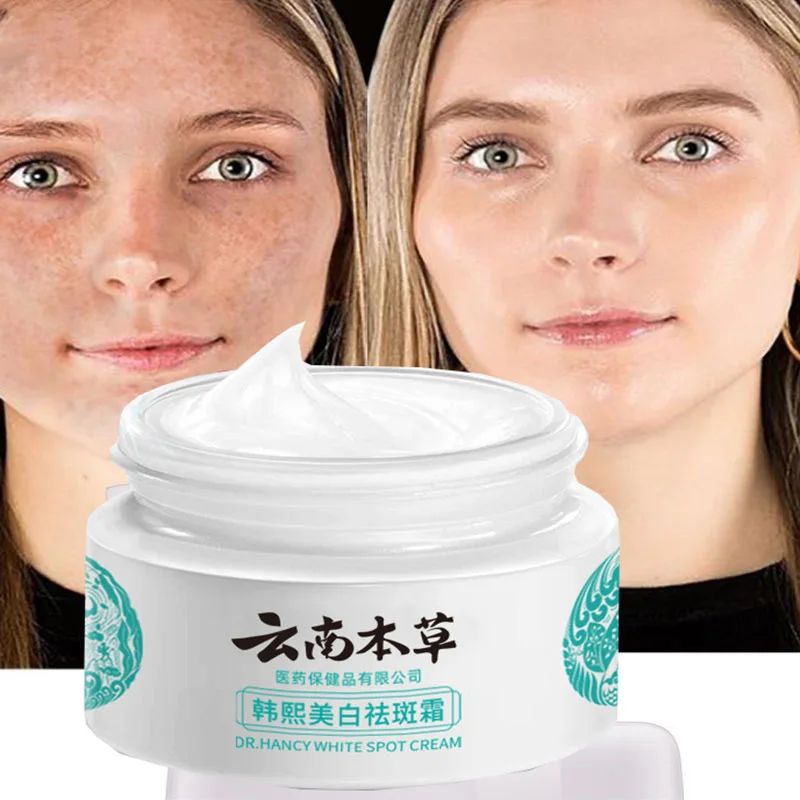 

Whitening Cream Face Freckle Acne Fade Melanin Remover Chloasma Brighten Age-spots Care Dark Spots Skin Nourish Moisturizing