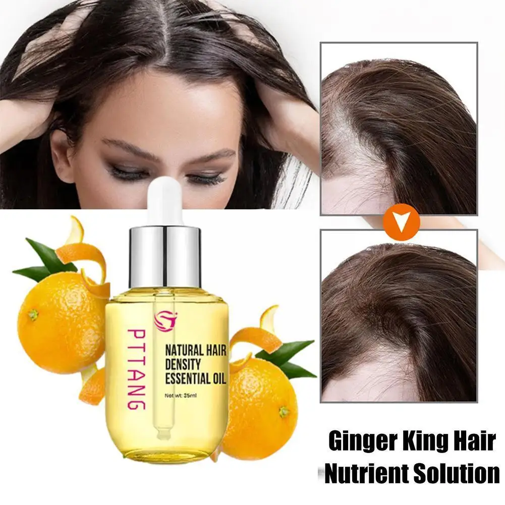 

Имбирные продукты, предотвращающие выпадение волос, эфирное масло, быстрорастущее лечение кожи головы, красота, здоровье для мужчин и женщин Z4T0