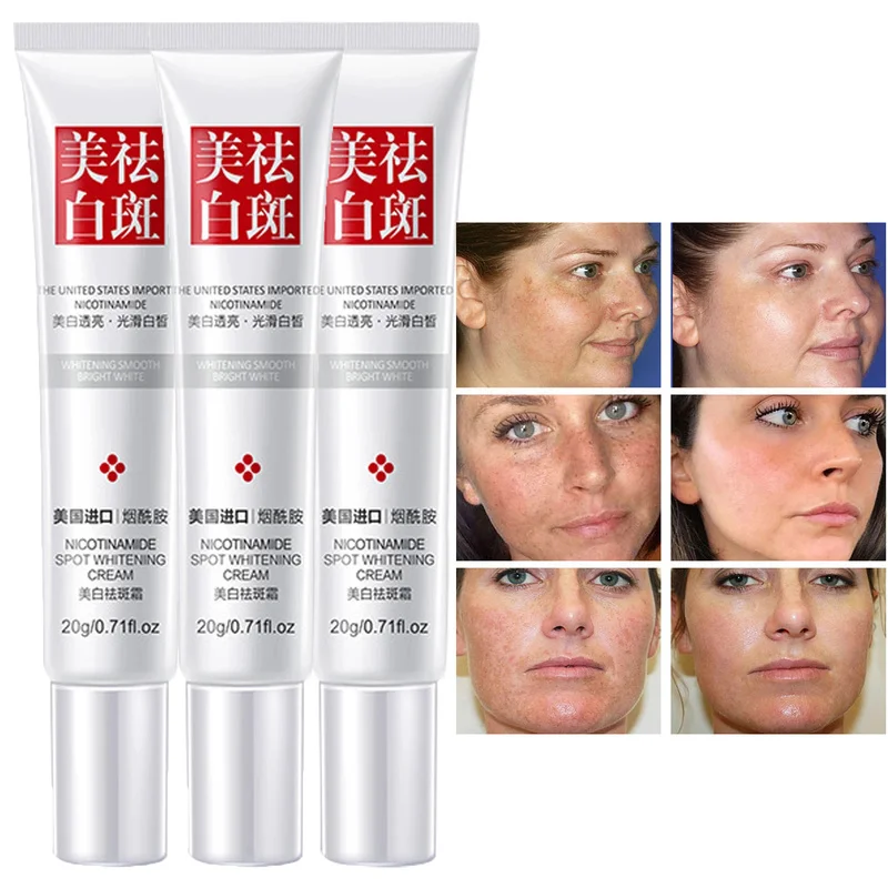 

3pcs/1pcs Niacinamide Whitening Cream Fades Freckle Dark Spots Face Gel Vitamin E Improve Dullness Brighten Nourish Skin Care