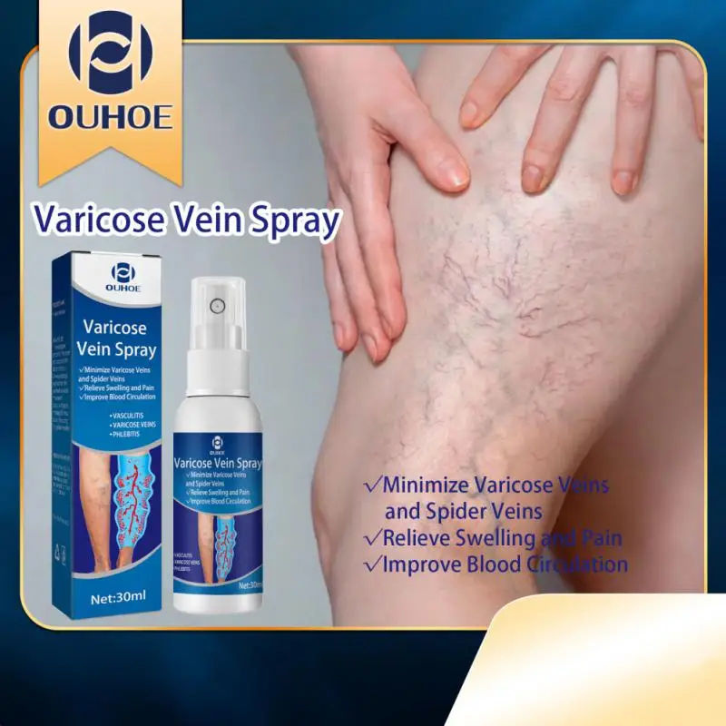 

Varicose Veins Spray Repair Leg Blood Vessels Bulge Redness Vasculitis Phlebitis Pain Relieve Vein Healing Spray