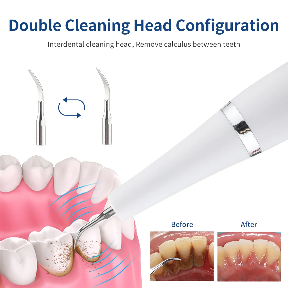 Ультразвуковой Зубной скалер очиститель зубов отбеливание зубного камня