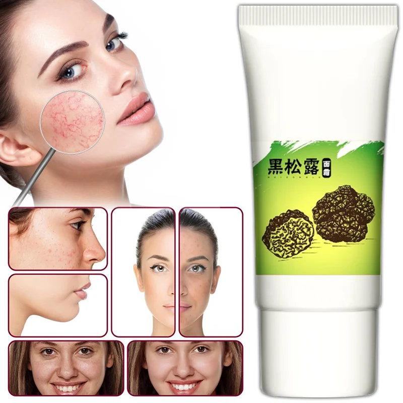 

Black Truffle Cream Deep Hydrating Moisturizing Tension Tight Anti-wrinkle Desalinating Fine-grain Skin Care Stay Up Night Cream