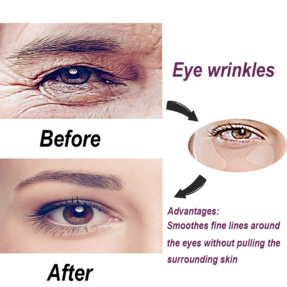 Рисунок 4 - Многоразовые патчи для морщин