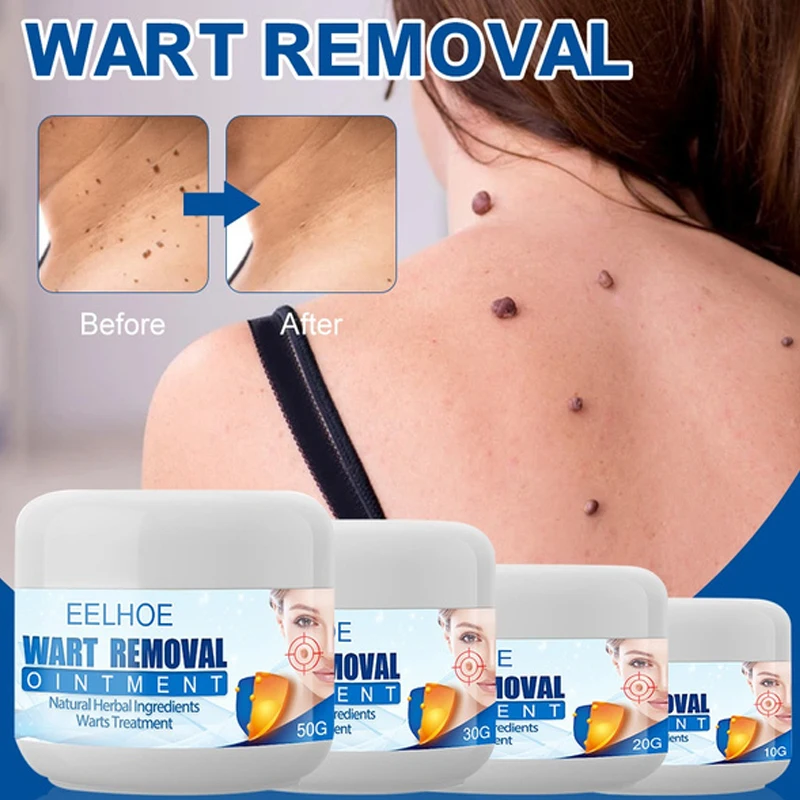 

Wart Cream Genital Warts Ointment Treatment Wart Removal Papillomas Skin Tags Mole Removal Wart Remedy Skin Care 10/20/30/50g