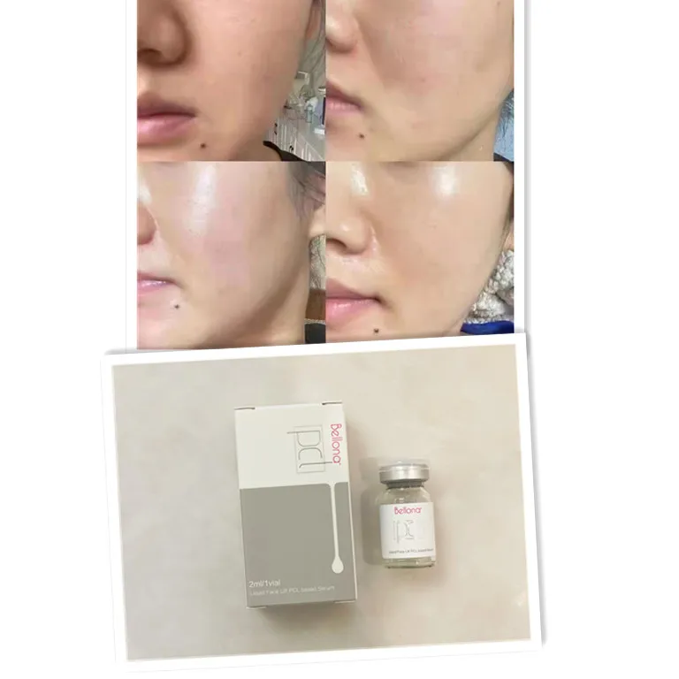 

New 2022 Bellona Pcl 2ml Age Anti-Wrinkle Increase Collagen Production Face Lifting skin rejuvenated