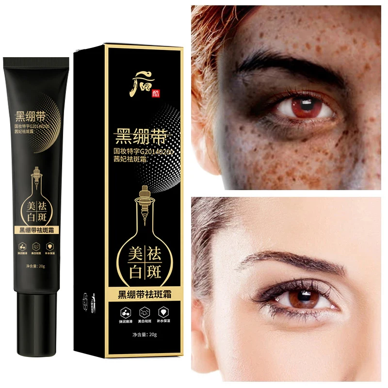 

Effective Whitening Freckle Cream Remove Melasma Acne Spot Pigment Melanin Dark Spots Pigmentation Moisturizing Gel Skin Care