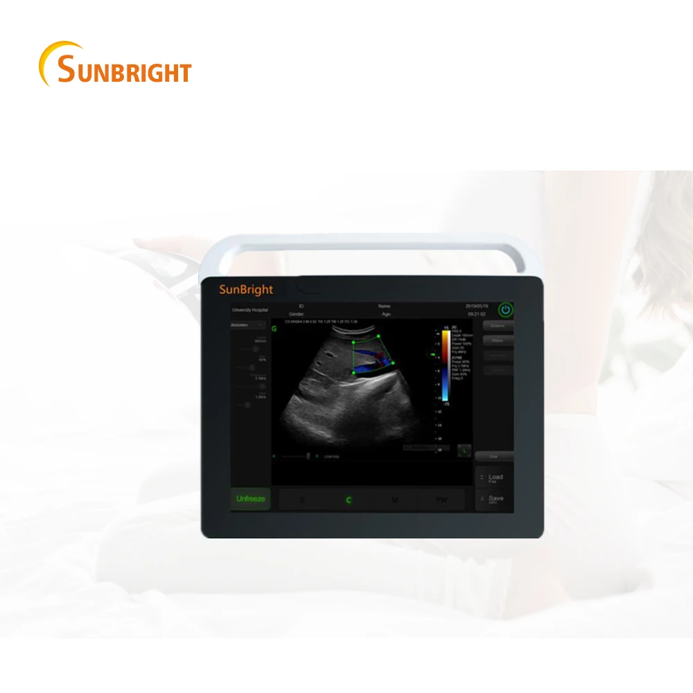

Medical Ultrasound Instruments Human Use Digital Sunbright BW Ultrasound USG 2D echo