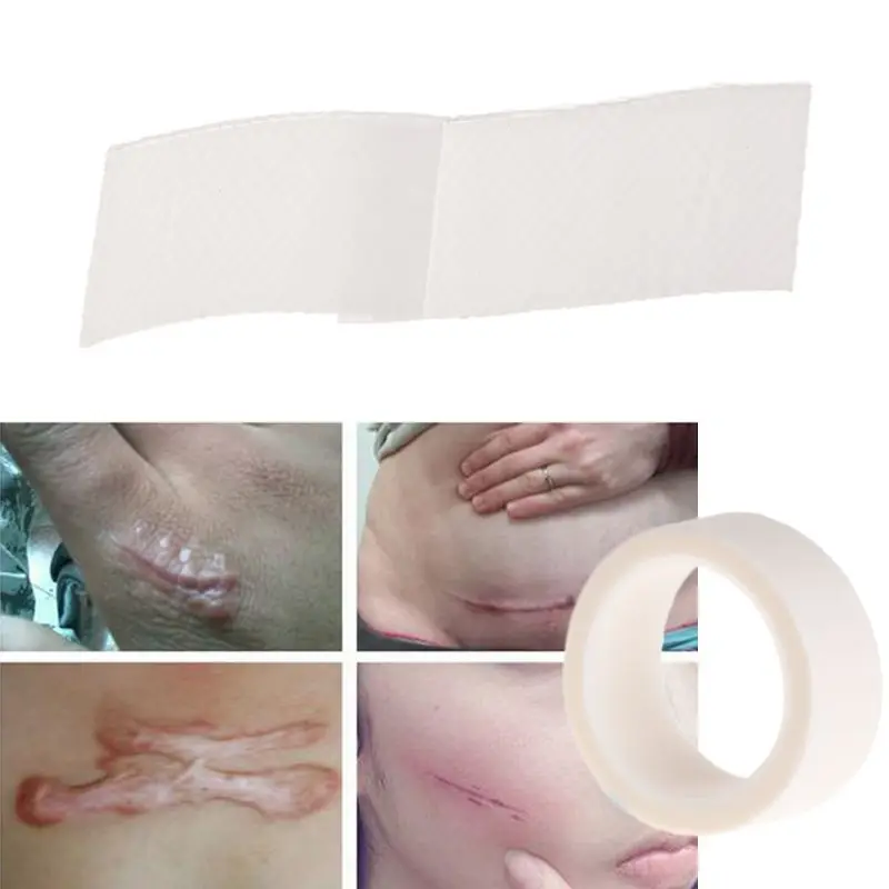 

Scar Away Treatment Sheet Tape Repair Silicone Gel Strips Patch Medical Reusable