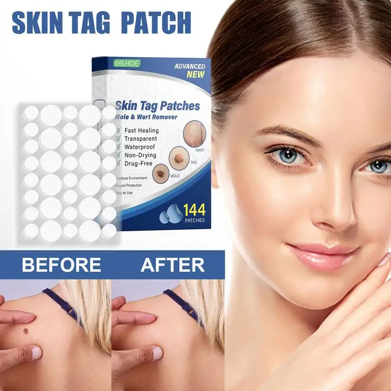 

144pcs Skin Tag Remover Patches Mole Wart Removing Sticker Natural Ingredients Skin Tag Foot Corn Plaster Acne Removal Patch Kit
