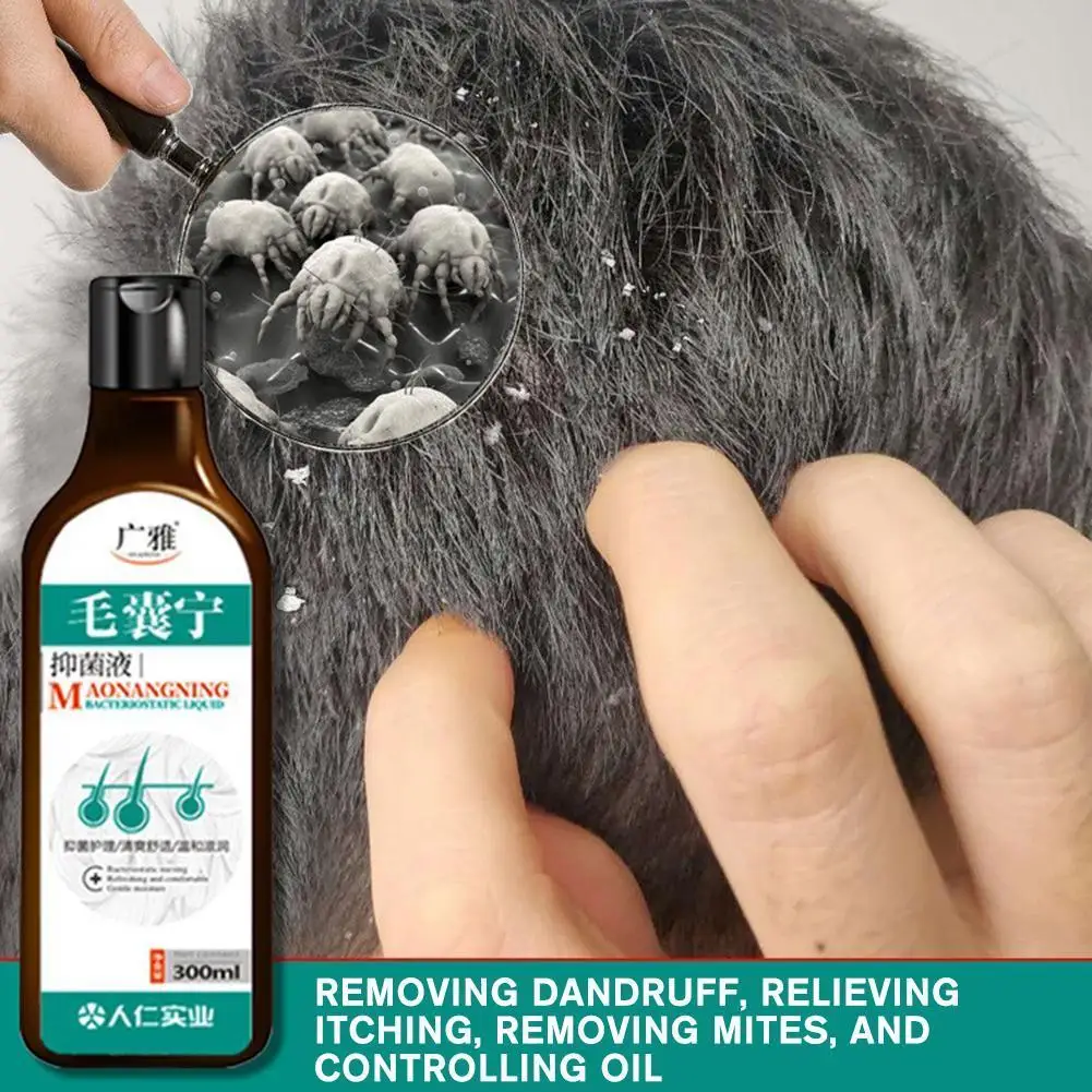 

Anti-Dandruff Anti-Itch Shampoo Chinese Herbal Hair Mite Seborrheic dry волос Care shampoo шампунь для Scalp Folliculitis P7P4