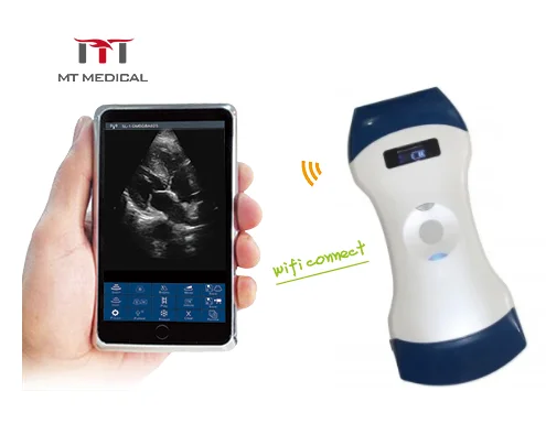 New Style 128 Elements 3 In 1 Double Head Color Doppler Mini Wifi Handheld Wireless Ultrasound Three Probe Scanner