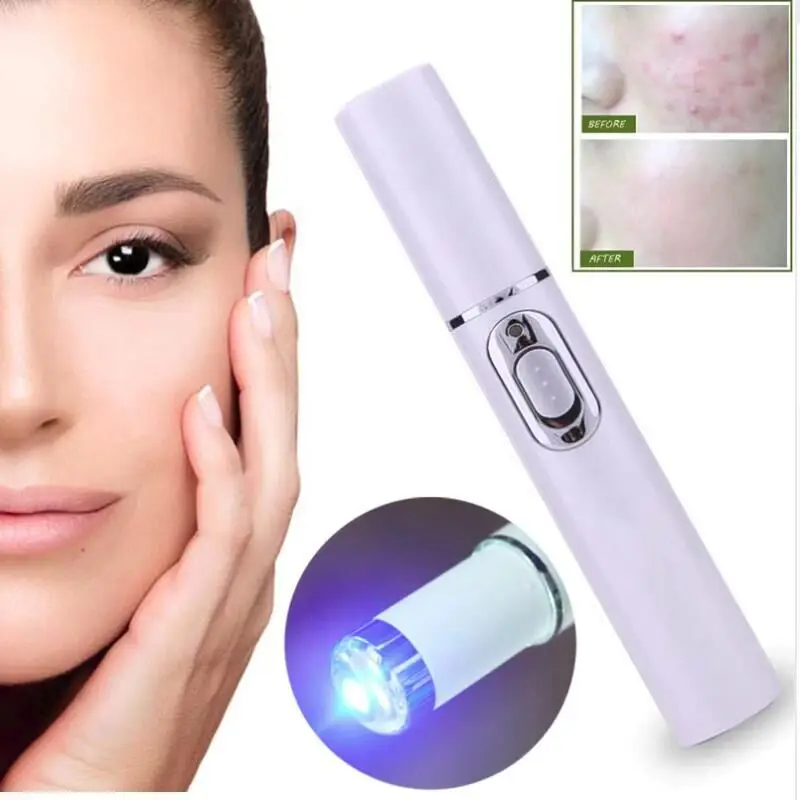 

Light Acne Pen Eye Massager Dark Circle Removal Dark Circles Eyes Massage Stick Eye Beautification Instrument Face Massager