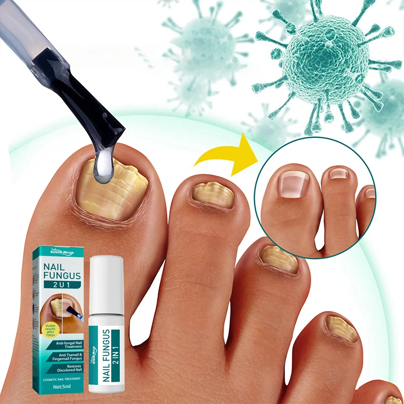 

Лечение грибка для ногтей, Восстанавливающее Средство для ногтей, грибковое средство для ногтей, лечение онихомикоза, паронихии