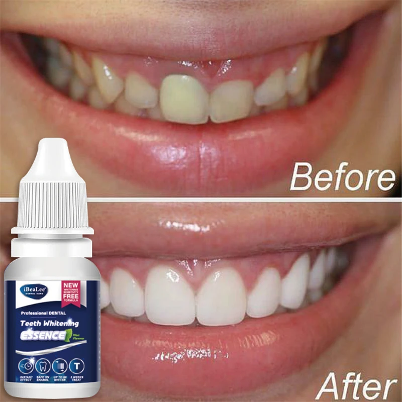 

Effective Teeth Whitening Essence Remove Plaque Stains Oral Hygiene Bleaching Serum Cleansing Fresh Breath Dentistry Care Tools