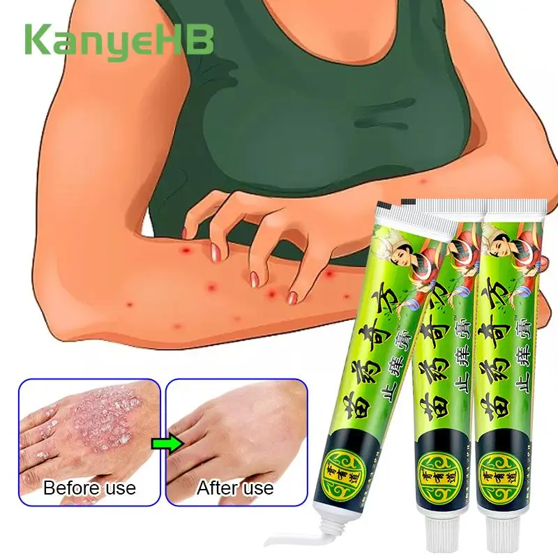 

3Pcs Psoriasis Cream Remove Odor Eczema Dermatitis Tinea Relieve Allergy Scrotal Itching Skin Care Ointment Against Fungi A1443