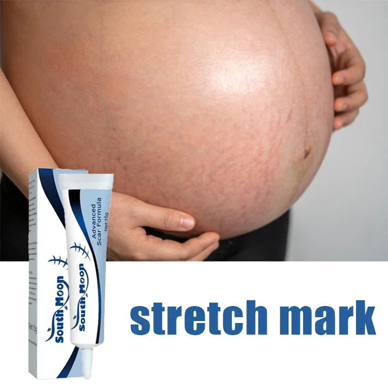 HOT SALE Maternity Cream That Enhances Elasticity Gentle Skin Care After Pregnancy Eliminates Stretch Marks and Is Very Effec
