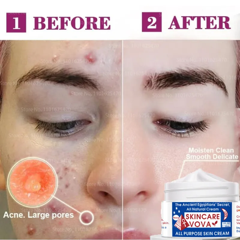 

Multipurpose Skin Cream Skin Anti-Aging Stretch Marks Cellulite Irritation and Other Natural Treatments 100% Natural Ingredients