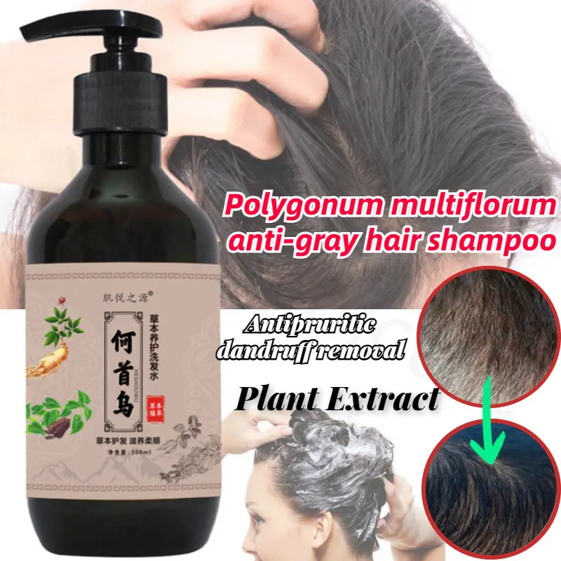 

Natural Plant Extract Polygonum Multiflorum Black Hair Anti-white Hair Anti-dandruff Anti-itch Herbal Hair Nourishing Shampoo