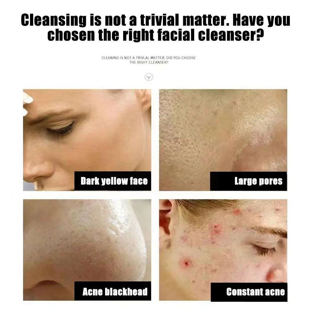 Рисунок 6 - Средство для удаления веснушек