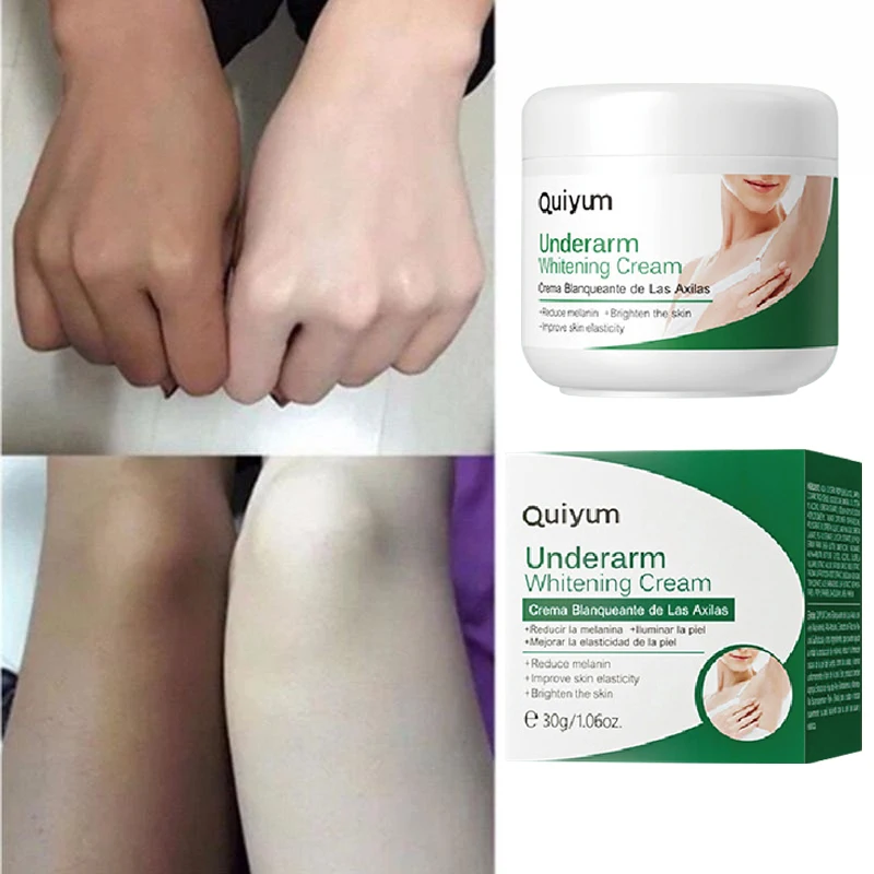 

Effective Improve Body Whitening Cream Armpit Legs Knee Elbow Bleaching Cream Dull Remove Dark Spots Melanin Brighten Skin Care