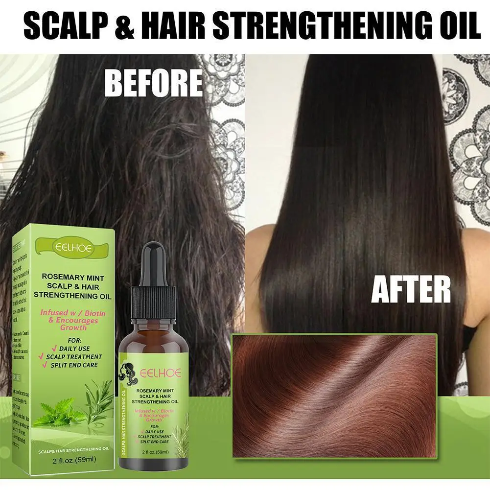 

5 Days FastHair Growth Natural Liquid Anti Hair Loss Damaged Prevent Treatment Baldness Nourish Dry Hair Growth Products O7U2