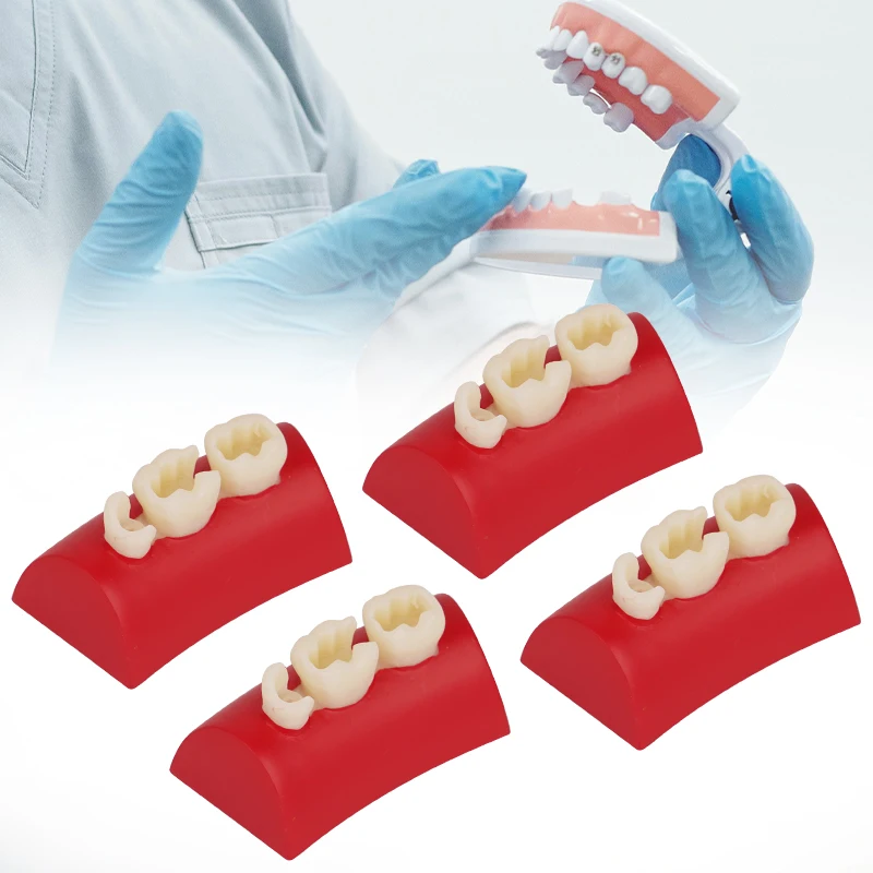 Модель ротового наполнения стоматологическая инкрустация модель для упражнений