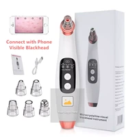 strong suction 5 heads pore cleaner blackhead removal tool kit acne vacuum blackhead remover with camera