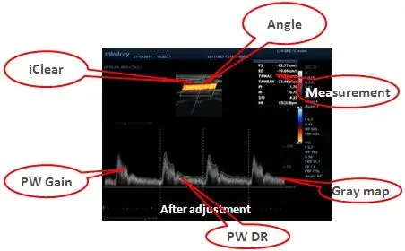 Рисунок 4 - Система ультразвуковой визуализации