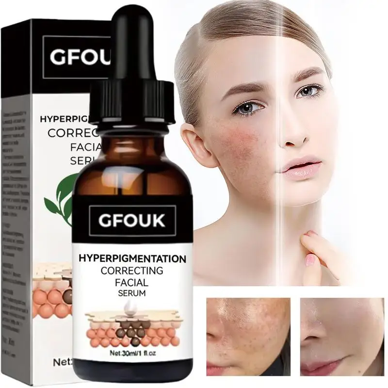 

30ml Black Spot Corrector Serums Brightening Moisturizing Lightening Essence Reduce Facial Line For All Skin Types