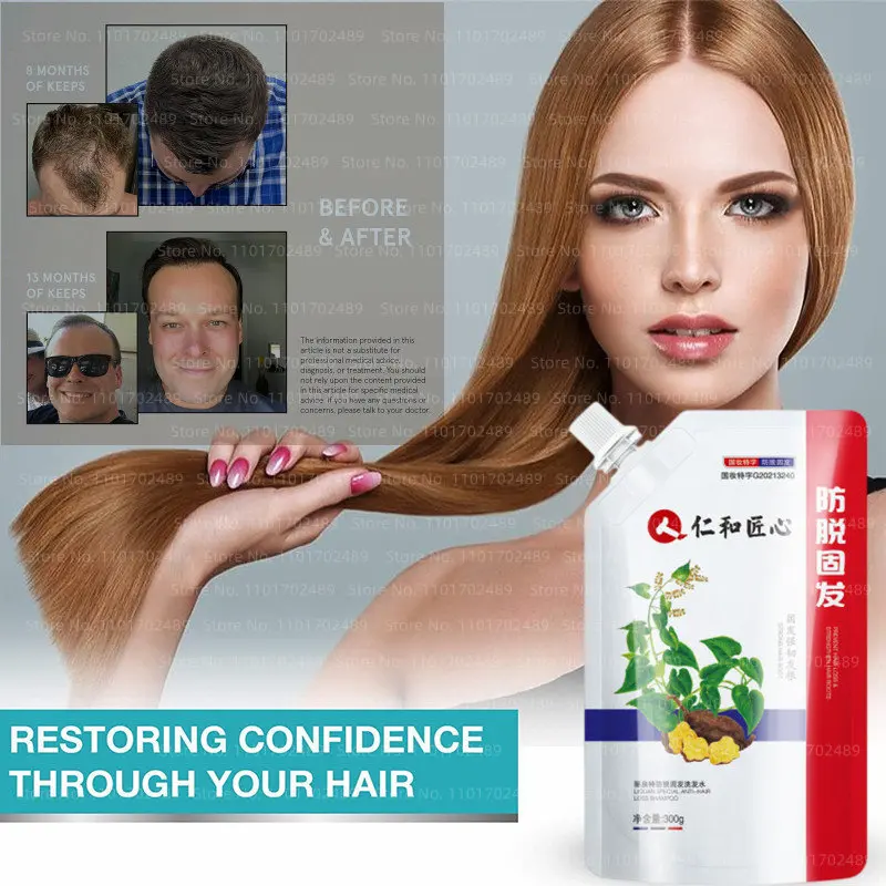 

Hair Growth Shampoo Thickening Hair Loss Treatment Regrowth Anti-Thinning Hair Care Products Herbal Healthy Scalp for Men Women