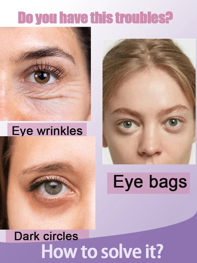 2024 никотинамид крем для глаз темные круги выцветание мешков под глазами