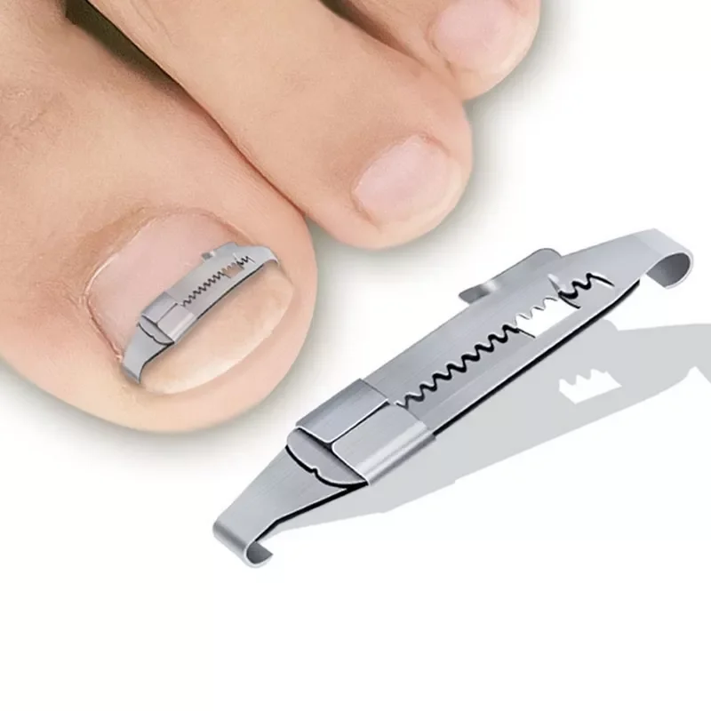 

NEW steel Ingrown Toenail Pedicure Tool Straightening Correction Clip Curved Brace Toenails Thick Paronychia Correction
